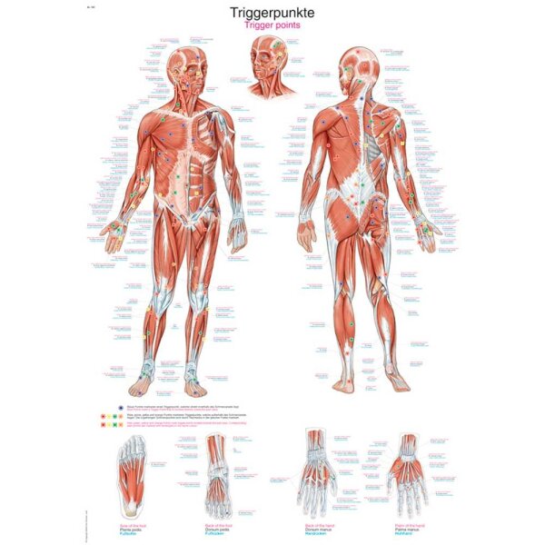 Erler Zimmer Anatomical Chart "Trigger Points", Different Sizes