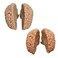 Erler Zimmer Human Brain, Actual Cast, 2 Variants