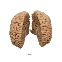Erler Zimmer Human Brain, Actual Cast, 2 Variants