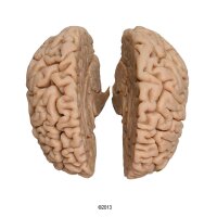 Erler Zimmer Human Brain, Actual Cast, 2 Variants