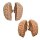 Erler Zimmer Human Brain, Actual Cast, 2 Variants